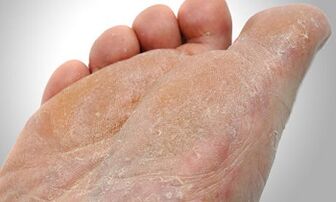 Putevi prijenosa gljiva stopala