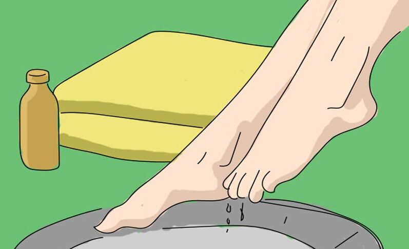 Kupka od jabučnog octa protiv gljivica stopala